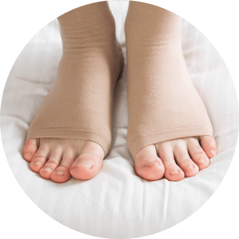 Oncology & Lymphedema Management Santa Cruz