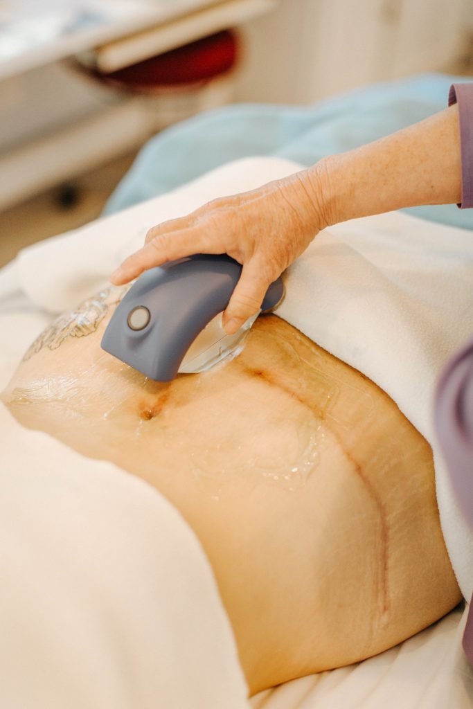 Focused Acoustic Shockwave Therapy Santa Cruz